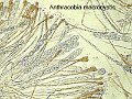 Anthracobia macrocystis-amf554-micro